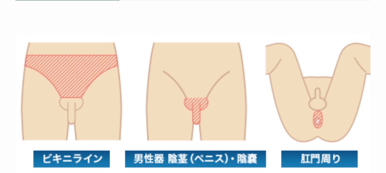 男性のビキニライン、陰茎・陰嚢、肛門周りの位置を示す部位説明図。照射可能範囲を示すものではありません